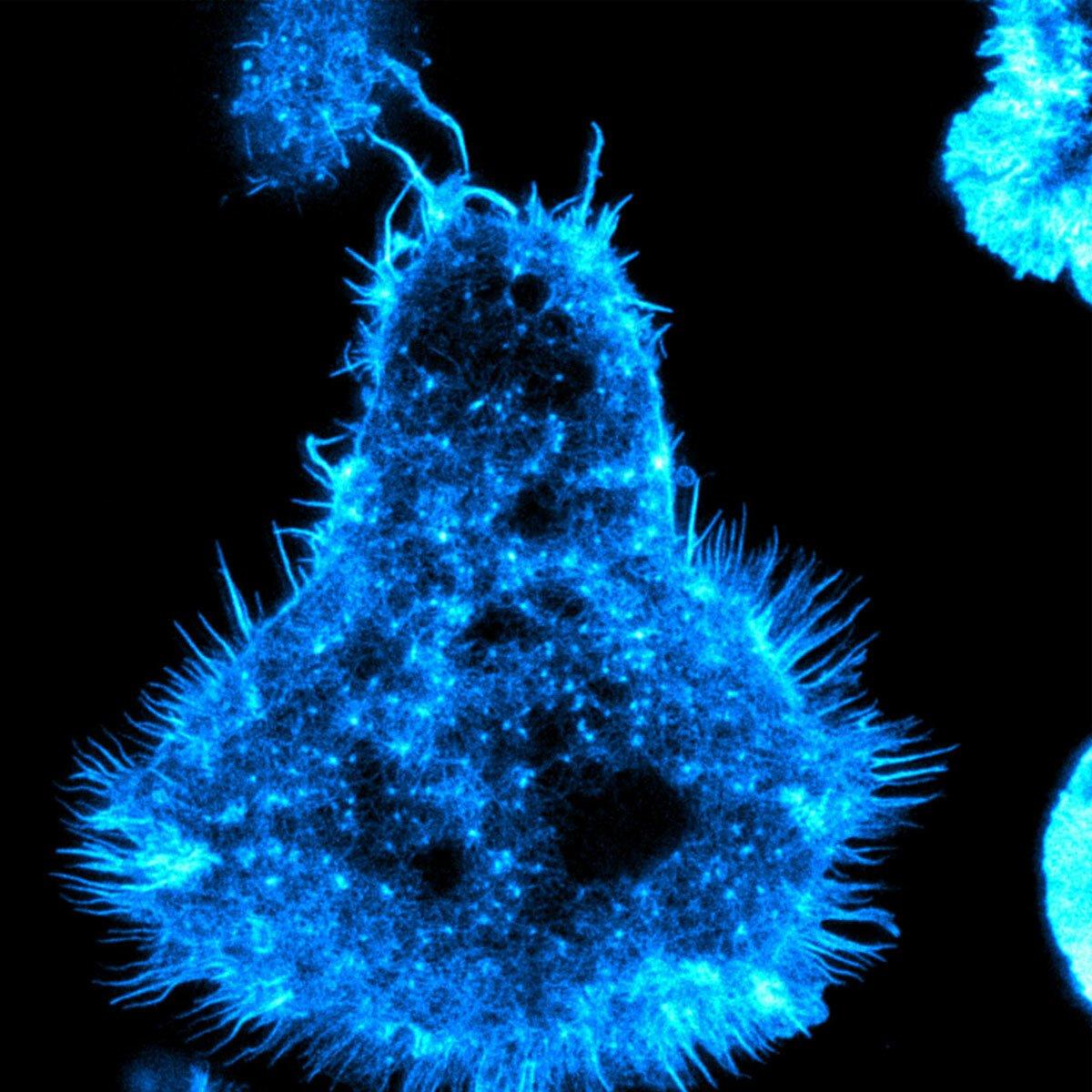 A high-resolution image of a natural killer cell