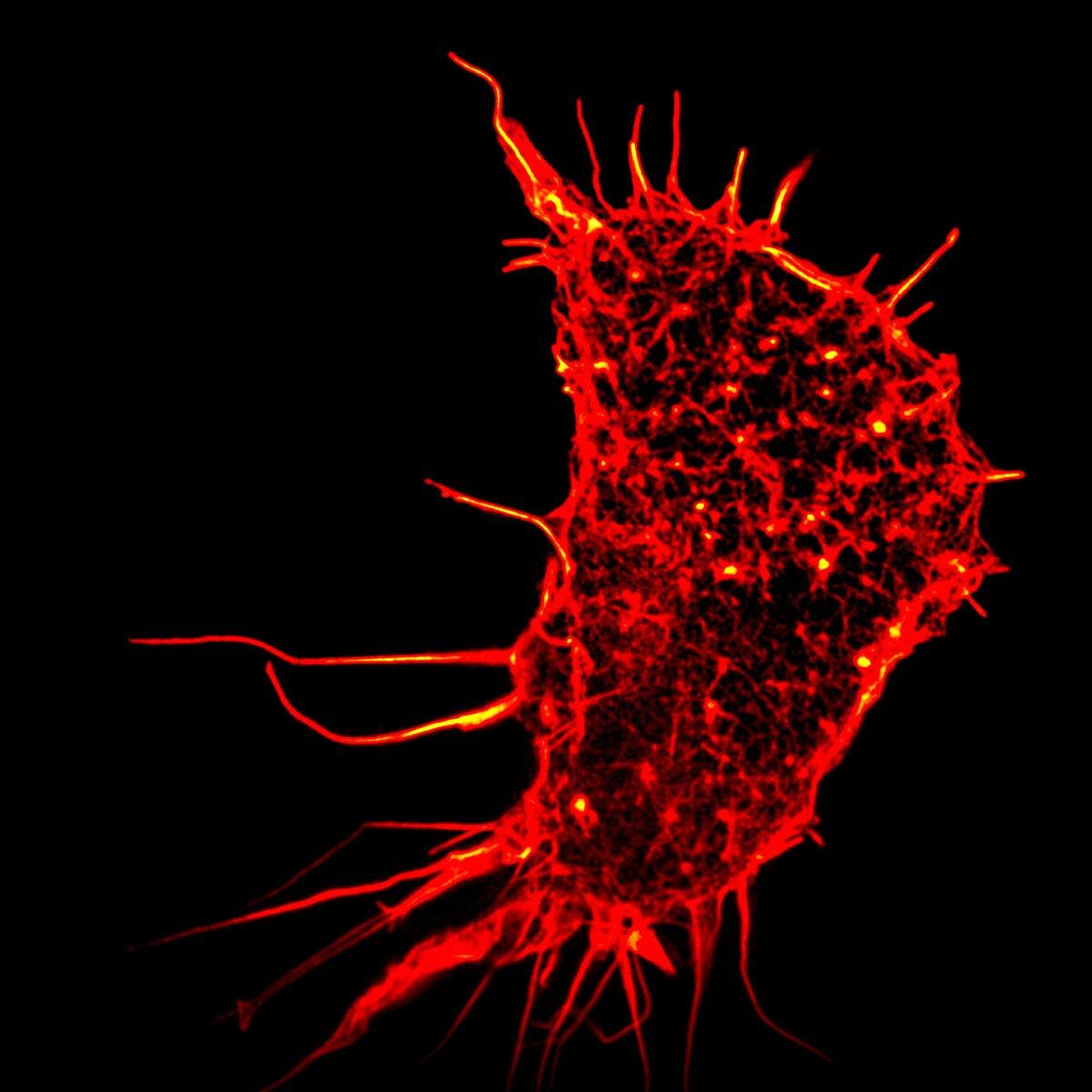 A single human kidney cell using super-resolution microscopy