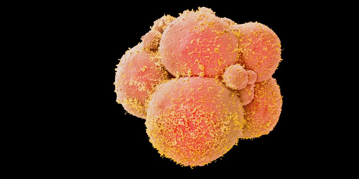 Coloured scanning electron micrograph of a human embryo at the eight-cell stage